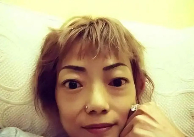 豪门婚姻8年噩梦：名模沦为玩物，牙齿全脱落，不足80斤形似骷髅