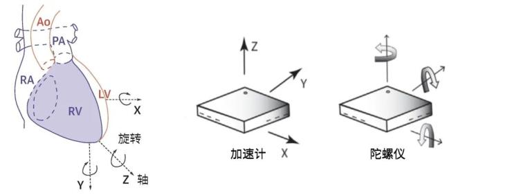 手机放胸口 2 分钟就能发现致命心脏病？准确率 89%